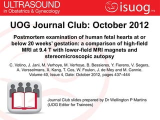 UOG Journal Club: October 2012
  Postmortem examination of human fetal hearts at or
 below 20 weeks’ gestation: a comparison of high-field
     MRI at 9.4 T with lower-field MRI magnets and
              stereomicroscopic autopsy
C. Votino, J. Jani, M. Verhoye, M. Verhoye, B. Bessieres, Y. Fierens, V. Segers,
    A. Vorsselmans, X. Kang, T. Cos, W. Foulon, J. de Mey and M. Cannie.
            Volume 40, Issue 4, Date: October 2012, pages 437–444




                     Journal Club slides prepared by Dr Wellington P Martins
                     (UOG Editor for Trainees)
 