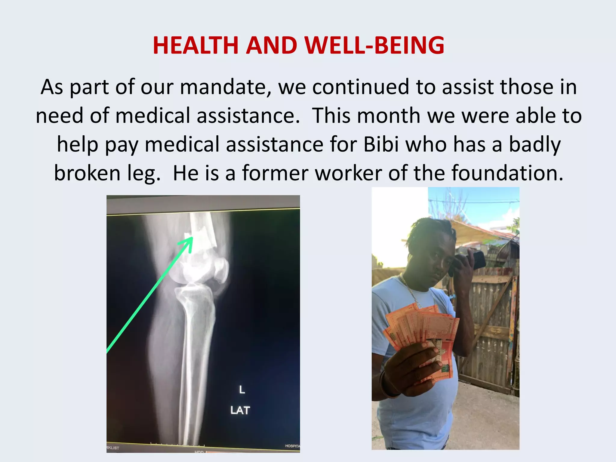 HEALTH AND WELL-BEING
As part of our mandate, we continued to assist those in
need of medical assistance. This month we were able to
help pay medical assistance for Bibi who has a badly
broken leg. He is a former worker of the foundation.
 