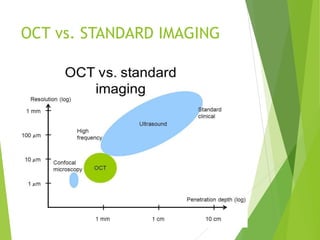 Optical Coherence Tomography [OCT] | PPTX