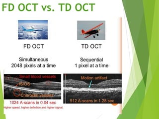 Optical Coherence Tomography [OCT] | PPTX