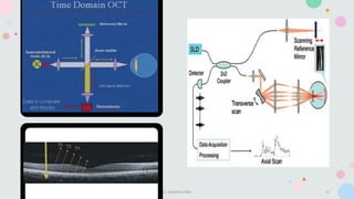 Optical Coherence Tomography & its interpretation.pptx