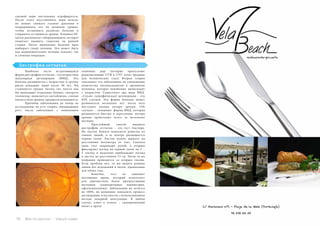 76 Bсе по-русски - Vse po russki Vse po russki - Bсе по-русски 77
глазной нерв постепенно атрофируется.
После этого восстановить нерв нельзя,
но можно снижать глазное давление и
поддерживать его на должном уровне,
чтобы остановить развитие болезни и
сохранить оставшееся зрение. Клиника Of-
talvist располагает оборудованием, которое
помогает выявить глаукому на ранней
стадии. После выявления болезни врач
выбирает схему лечения. Это может быть
как медикаментозное лечение (капли), так
и сложная операция.
Дистрофия сетчатки
	 Наиболее часто встречающаяся
форма дистрофии сетчатки – это возрастная
макулярная дегенерация (ВМД). Эта
болезнь развивается с возрастом: в группу
риска попадают люди после 50 лет. Им
становится трудно читать (из текста как
бы пропадают отдельные буквы), смотреть
телевизор, появляется светобоязнь, слепые
пятна в поле зрения, предметы искажаются.
	 Причины заболевания до конца не
исследованы, но есть теория, связывающая
рост числа заболевших с появлением
озоновых дыр (которые пропускают
радиоактивные UVB и UVC лучи, вредные
для человеческих глаз). Вторая теория
списывает это заболевание на уменьшение
количества антиоксидантов в организме
человека, которое неизбежно происходит
с возрастом. Существует два вида ВМД.
«Сухая» (атрофическая) дегенерация – это
85% случаев. Эта форма болезни может
развиваться несколько лет, после чего
наступает полная потеря зрения. 15%
случаев – «влажная» форма ВМД, которая
развивается быстро и агрессивно: потеря
зрения происходит всего за несколько
месяцев.
	 Простейший способ выявить
дистрофию сетчатки – это тест Амслера.
На листок бумаги наносится решетка из
тонких линий, в ее центре размещается
черная точка. Листок нужно держать на
расстоянии полуметра от глаз. Сначала
один глаз закрывают рукой, а вторым
фиксируют взгляд на черной точке на 2 –
5 секунд и медленно приближают взгляд
к листку до расстояния 15 см. Затем та же
операция проводится со вторым глазом.
Если проблем нет, то вы видите ровные
линии без искажений и пятен, одинаковые
для обоих глаз.
	 Конечно, тест не заменяет
посещение врача, который использует
для диагностики более прогрессивные
методики (компьютерная периметрия,
офтальмоскопия). Заболевание не лечится
на 100%, но возможно замедлить процесс
дегенерации, в частности, с использованием
метода лазерной коагуляции. В любом
случае, ключ к успеху – своевременный
визит к врачу.
 