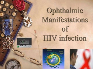 Ophthalmic
Manifestations
of
HIV infection
OPH
MCK
 