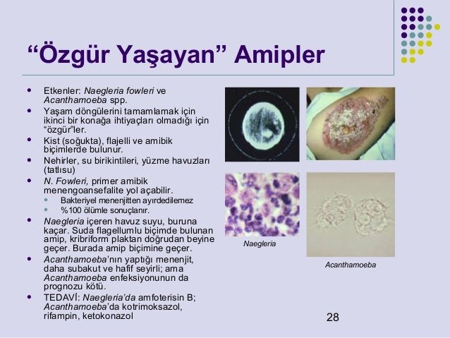 Yenidoğanda anemi nedir Yenidoğanda anemi nedir