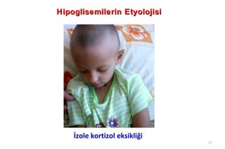 Hipoglisemilerin Etyolojisi




    İzole kortizol eksikliği
                               23
 