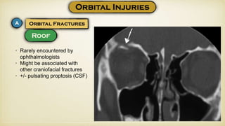 • Rarely encountered by
ophthalmologists
• Might be associated with
other craniofacial fractures
• +/- pulsating proptosis (CSF)
 