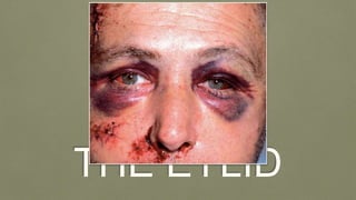 THE EYLID
 