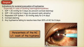 Indications for surgical evacuation of hyphaema:
Especially In case of Sickling haemoglobinopathies:
1. IOP > 25 mmHg for 5 days (to prevent corneal staining)
2. IOP > 60 mmHg for 2 days (to prevent optic atrophy)
3. Repeated IOP spikes > 30 mmHg daily for 2-4 days
4. Corneal staining
5. Any hyphaema failing to resolve less than 50% of AC for 8 days
 