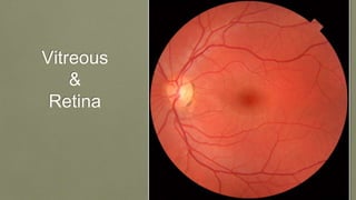 Vitreous
&
Retina
 