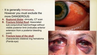 • It is generally innocuous,
However you must exclude the
more DANGEROUS:
A. Ruptured Globe: clinically, CT scan
B. Fracture Orbital Roof: Associated
sub-conjunctival haemorrhage without
visible posterior limit (indicates anterior
extension from a posterior bleeding
point)
C. Fracture base of the skull:
characteristic bilateral ring hematoma
(Panda eye)
 