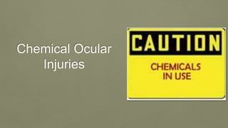 Chemical Ocular
Injuries
 