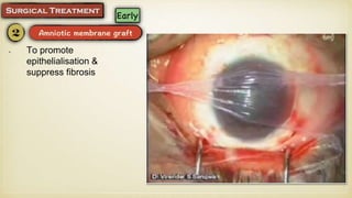 To promote
epithelialisation &
suppress fibrosis
 
