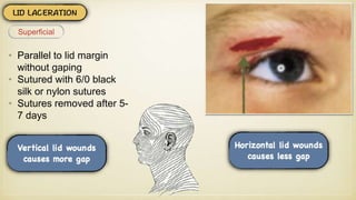 • Parallel to lid margin
without gaping
• Sutured with 6/0 black
silk or nylon sutures
• Sutures removed after 5-
7 days
Superficial
 