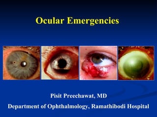 Ocular Emergencies Pisit Preechawat, MD Department of Ophthalmology, Ramathibodi Hospital 