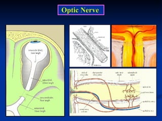 Optic Nerve 