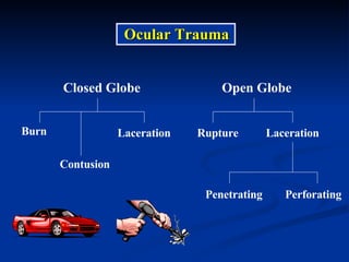 Ocular Trauma Closed Globe Open Globe Burn Contusion Laceration Laceration Penetrating Perforating Rupture 