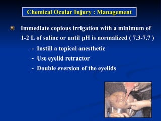 Immediate copious irrigation with a minimum of  1-2 L of saline or until pH is normalized ( 7.3-7.7 ) -  Instill a topical anesthetic -  Use eyelid retractor -  Double eversion of the eyelids Chemical Ocular Injury : Management 