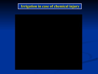 Irrigation in case of chemical injury 