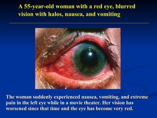 The woman suddenly experienced nausea, vomiting, and extreme pain in the left eye while in a movie theater. Her vision has worsened since that time and the eye has become very red.  A 55-year-old woman with a red eye, blurred vision with halos, nausea, and vomiting 