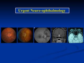 Urgent Neuro-ophthalmology 