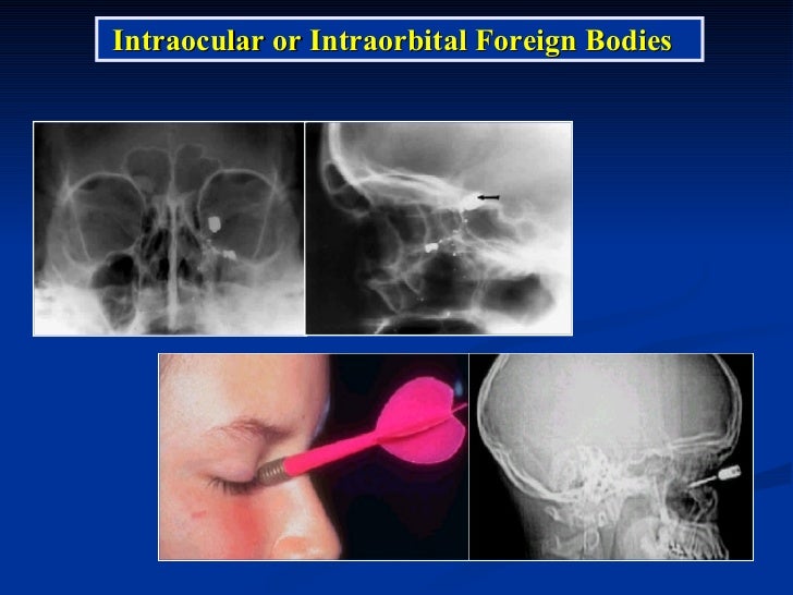 The Average Cost Of An Eye Exam Without Insurance Pocketsense