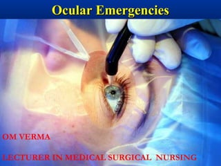 Ocular EmergenciesOcular Emergencies
OM VERMA
LECTURER IN MEDICAL SURGICAL NURSING
 