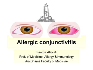 Fawzia Abo ali
Prof. of Medicine, Allergy &Immunology
Ain Shams Faculty of Medicine
Allergic conjunctivitis
 