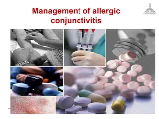 Management of allergic
conjunctivitis
 