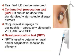 Tear fluid IgE can be measured.
Conjunctival provocation test
(CPT): It should be done with
standardized water-soluble allergen
extracts
Conjunctival scrapings for
eosinophils – particularly elevated in
VKC, AKC and GPC
Nasal provocation test (NPT)
• NPT is used to determine nasal
and/or conjunctival reaction to
allergens.
 