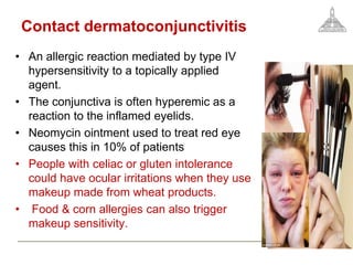 Contact dermatoconjunctivitis
• An allergic reaction mediated by type IV
hypersensitivity to a topically applied
agent.
• The conjunctiva is often hyperemic as a
reaction to the inflamed eyelids.
• Neomycin ointment used to treat red eye
causes this in 10% of patients
• People with celiac or gluten intolerance
could have ocular irritations when they use
makeup made from wheat products.
• Food & corn allergies can also trigger
makeup sensitivity.
 