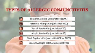 TYPES OF ALLERGIC CONJUNCTIVITIS
Seasonal Allergic Conjunctivitis(SAC)
Perennial Allergic Conjunctivitis(PAC)
Vernal Kerato-Conjunctivitis(VKC)
Atopic Kerato-Conjunctivitis(AKC)
Giant Papillary Conjunctivitis(GPC or CLPC)
Contact Allergic belpharoConjunctivitis
 