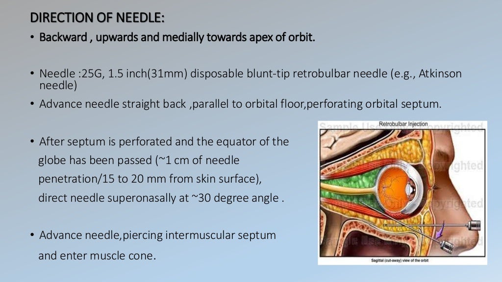 Ocular anaesthesia by dr.roopashree.c .r