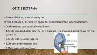 ocular and ear infection in microbiological aspects.pptx
