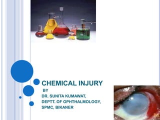 CHEMICAL INJURY
BY
DR. SUNITA KUMAWAT,
DEPTT. OF OPHTHALMOLOGY,
SPMC, BIKANER
 