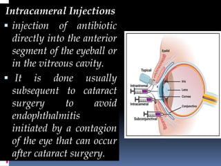 ocular DRUG DELIVERY SYSTEMS: MECHANISMS AND PROGRESSIONS | PPTX