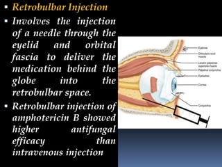 ocular DRUG DELIVERY SYSTEMS: MECHANISMS AND PROGRESSIONS | PPTX