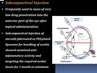 ocular DRUG DELIVERY SYSTEMS: MECHANISMS AND PROGRESSIONS | PPTX