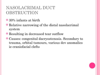 Ocular disease in peadiatric | PPT