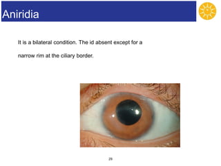 Ocular diseases.ppt