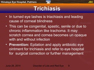 June 28, 2014 Disorder of Lids and Red Eye 8
JBCHimalaya Eye Hospital, Pokhara JBC
Trichiasis
• In turned eye lashes is triachiasis and leading
cause of corneal blindness
• This can be congenital, spastic, senile or due to
chronic inflammation like trachoma. It may
scratch cornea and cornea becomes un opaque
with and without infection
• Prevention: Epilation and apply antibiotic eye
ointment for trichiasis and refer to eye hospital
for surgical correction or further management
 