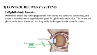 OCULAR DRUG DELIVERY SYSTEM.pptx