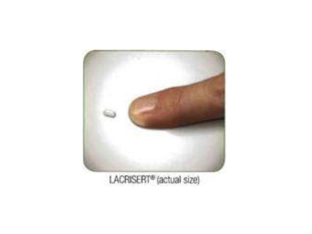 Bioadhesive ophthalmic drug insert