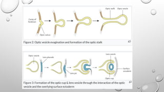 OCULAR EMBRYOLOGY development of the eye.pptx