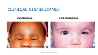 OCULAR EMBRYOLOGY described final 123.pptx