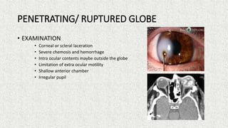 Ocular emergencies | PPTX