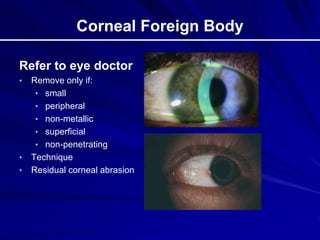 Corneal Foreign Body
Refer to eye doctor
• Remove only if:
• small
• peripheral
• non-metallic
• superficial
• non-penetrating
• Technique
• Residual corneal abrasion
 