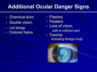 Additional Ocular Danger Signs
• Chemical burn
• Double vision
• Lid droop
• Colored halos
• Flashes
• Floaters
• Loss of vision
with or without pain
• Trauma
including foreign body
 