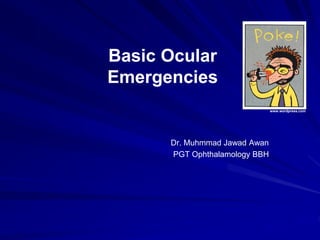 Basic Ocular
Emergencies
www.wordpress.com
Dr. Muhmmad Jawad Awan
PGT Ophthalamology BBH
 