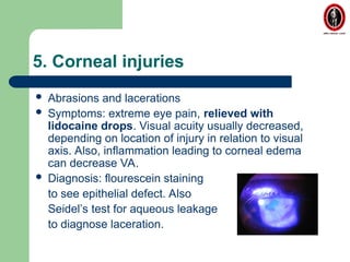 Comprehensive Guide to Ocular Emergencies: Diagnosis and Management | PPT