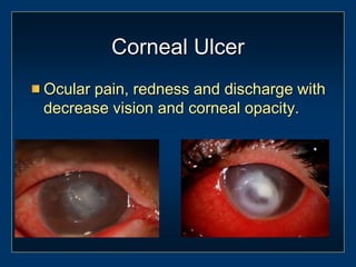 Ocular Emergencies and Red Eye Presentation w | PPT